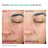 UV Skin Recovery Broad Spectrum SPF 50 Face Sunscreen