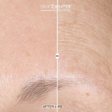 Even Glow Regimen