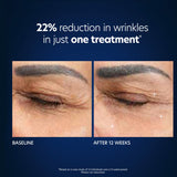 Hyaluronic Acid Microneedle Eye Patches