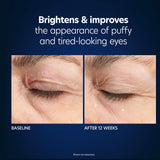 Hyaluronic Acid Microneedle Eye Patches