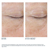 InterFuse Treatment Cream EYE
