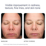 Triple Exfoliation Peel Pads