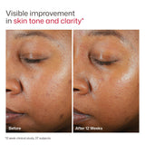 UV Clear Untinted Duo Kit