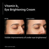 Vitamin b3 Eye Brightening Cream
